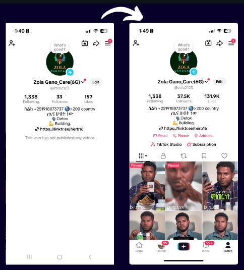Before & After Profile Growth